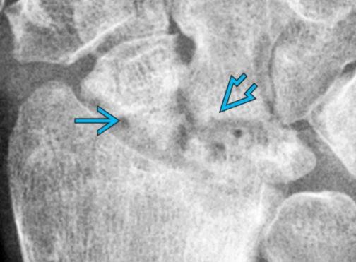 0c5ef38062645276cea6727407bc4093.png