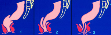 0fbd18650e9ef6373064ea8917e291dc.png