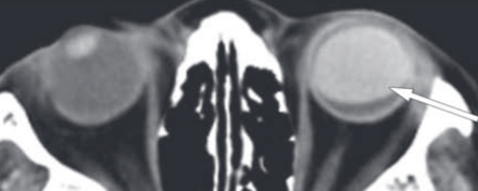 102ffcb021d35946db6ed14ad60a397b.png