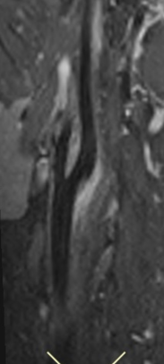 15f30d4a35de0fb47cc7583217148b2b.png
