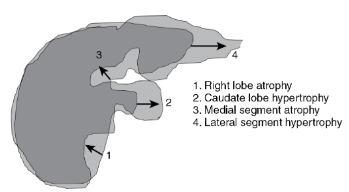 160e16018ebc969a19c73abc61768d85.png
