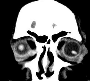 1efc21bdd748daea2190638fed2fefb7.png