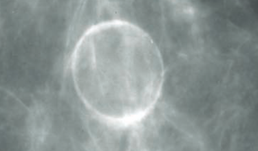 2610f3fd71ec12a778c973b692d35fe2.png