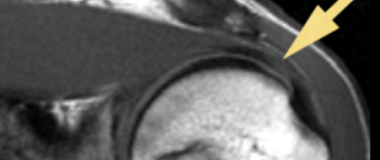 2903278a6a7e59ced8b1d5253eea196d.png