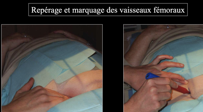 293575cc23422dcd7e93ecea62577e63.png