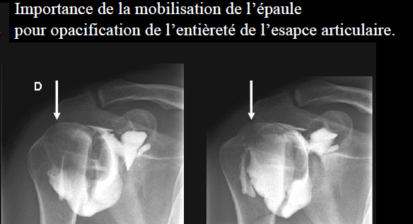 29aea48b08509d4987b2173ef0f945fa.png