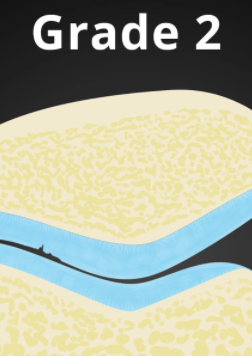2b1b36d5e3ffc65046a6d0ef561ba594.png