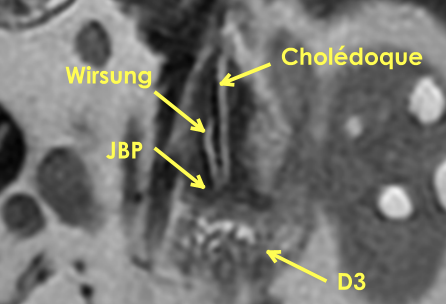 2c03678c1d04a041ca291af2a8117919.png