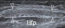 33eb796f68c954ce76b97b6ba7178834.png