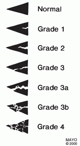 439db10e8cf780a3411c1730b222d121.png