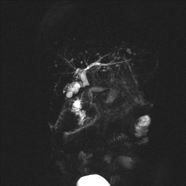 4dd27be70b51852ba213ce7d1411cb8e.png