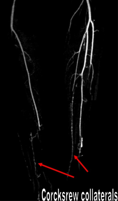 5254ca1e98a51a3bbd16c311bf5282c5.png