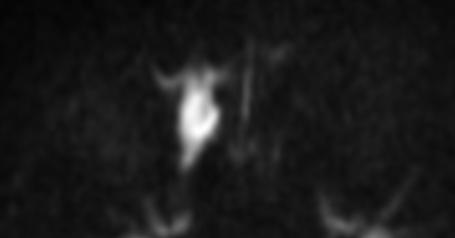52584ba03254ab26ac9319b7588cdb7a.png