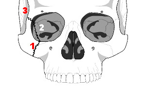 5658d03c323e114d915cf9b0a87fd117.png