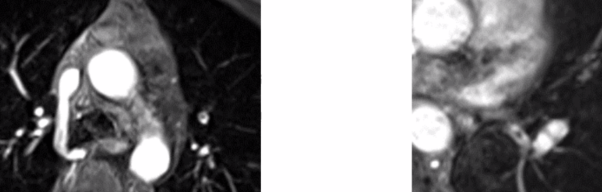 5b50cf85920cba95d07f615ef14d30bc.png