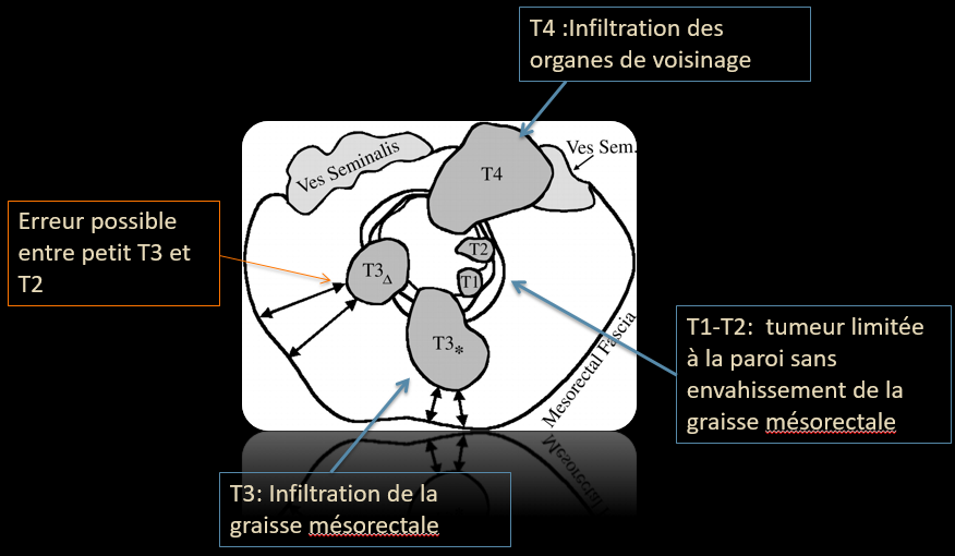 5dac5b10ff22f17657f7f1cc429bdad8.png
