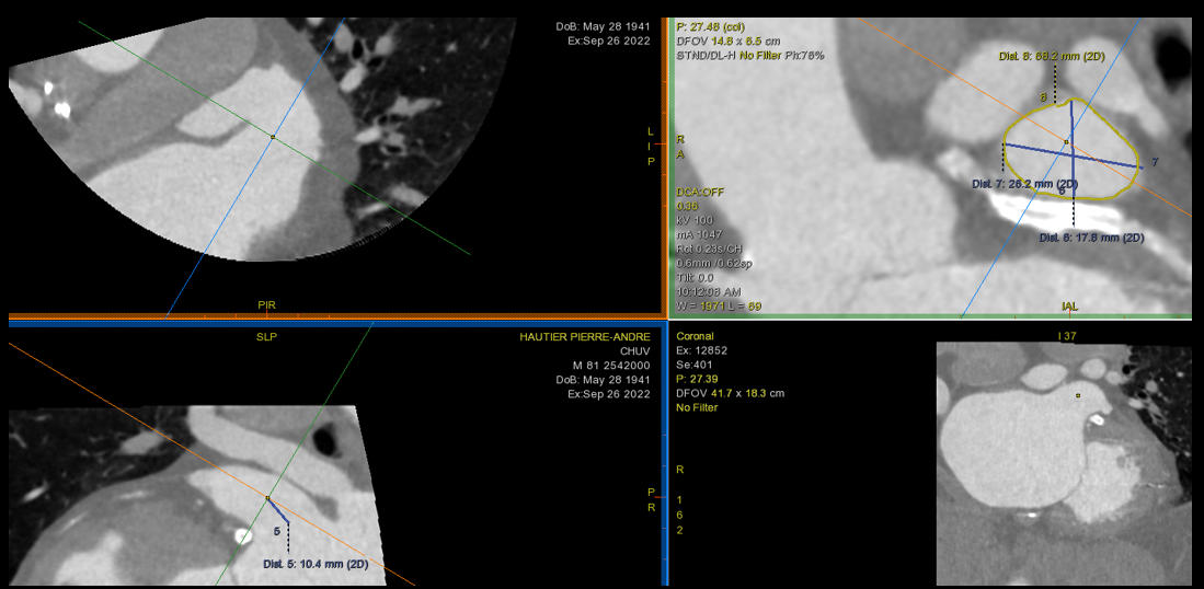 6521942ca99d5c42ddc7cb3d3bb52f21.png