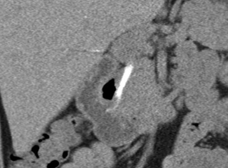 radiopaedia 