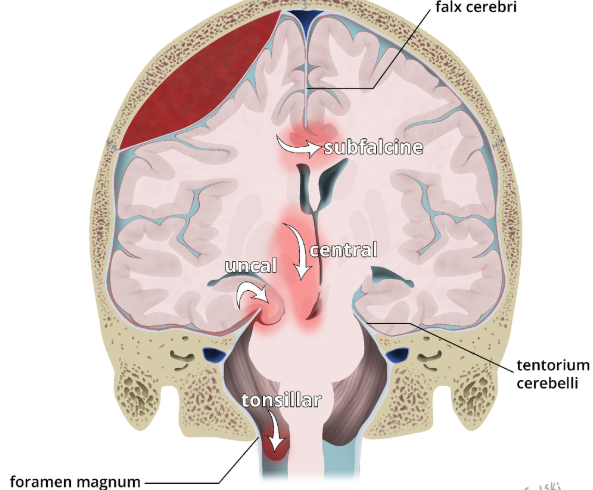 7abb9cbf1d2c8a0bb53b4a581bcc0f36.png