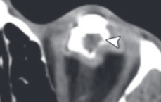 82b8d0fba0d08ecee40609ca27693f04.png