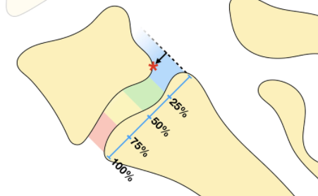 9552e1bcdd526423f2dc4a0140d5d129.png