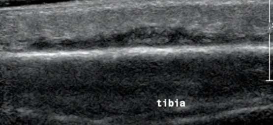 9622bd85e965a81a40c107b1d4372690.png