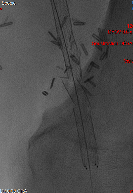9b5256bb264d93085abafd032b89071b.png