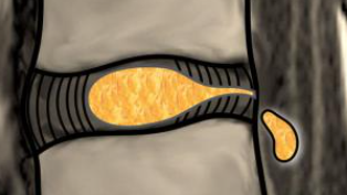a1148f2c46112d930c76650267e6668a.png