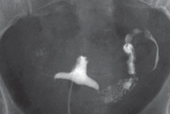 a2133ec16ee0c38b34f12fd5759955d2.png