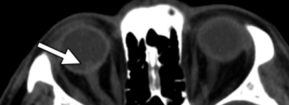 a42ee17a3e67150f50e2c753baee5886.png