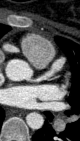 a745a46dedad355190e72bba52765305.png