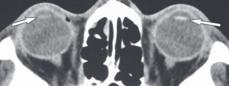 aadb21f37c2efa5fb9f7071f3bfaafdb.png