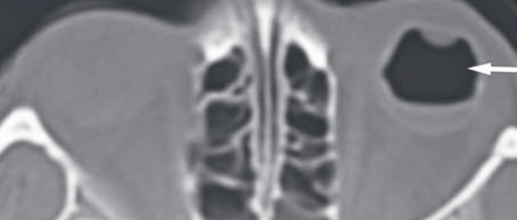 b05fdb91a671ccc58e8bda23fb7477d5.png