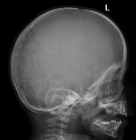 b171397f9ca78566a4d2508a087f5d1c.png