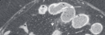 b4498414117970f7fd7823e4fd7ed602.png