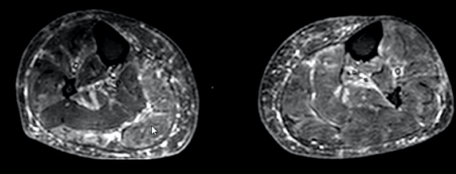 b5d0ce599a894016eb24b917dba8c97a.png