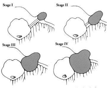 bcbf80c25a35e9d8f1098a52f6f26079.png