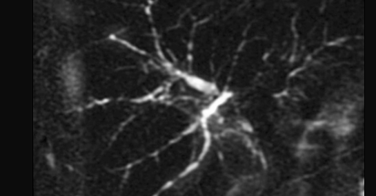 c26a1487964ef312f2d12d9880644c99.png