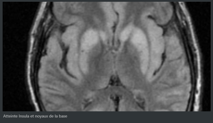 ca072f5ccf9a09102fd02e191304696e.png