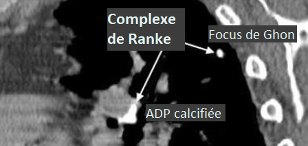 cb30b0a17f1689e374771fc9b05a719d.png