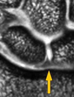 cc9925ca72954fafeb55cd120cae4d9d.png