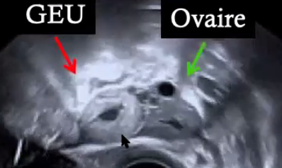ce79dc49951142f4af17bf9cf137e2ea.png