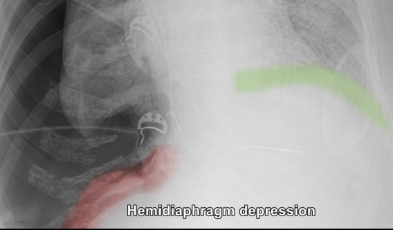 d31529b66a3f491b956b7e88341f37b0.png