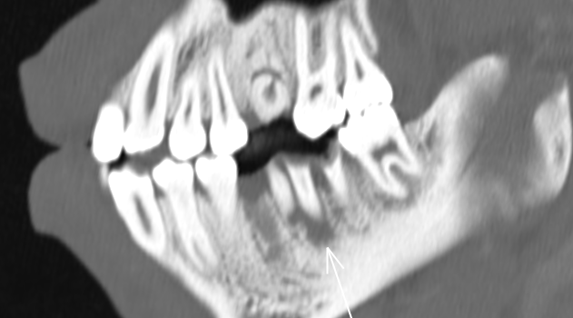 d3223072c10fa99b174251f4868f7772.png