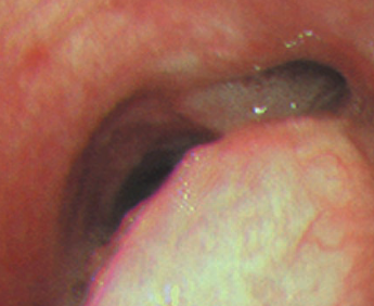 d40af684a734a10f6928aaf5116623fc.png