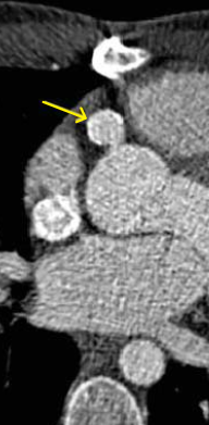 d51b6ec15f946deb8e0155df293b901b.png
