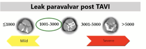 d656e6d5f527c2e7234d0a4de976f916.png