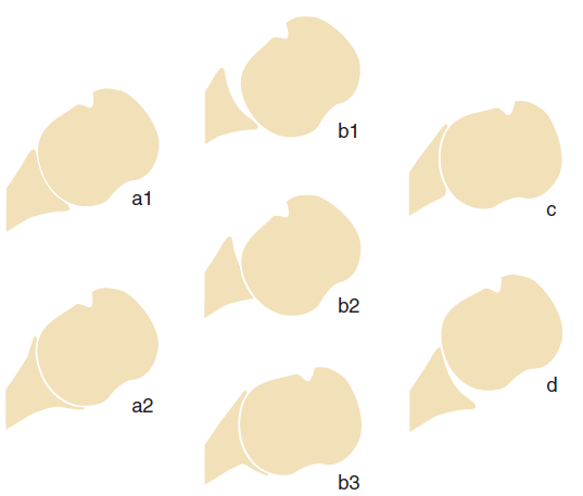 d77fb3e27e62983ebdd3eecaec07813f.png
