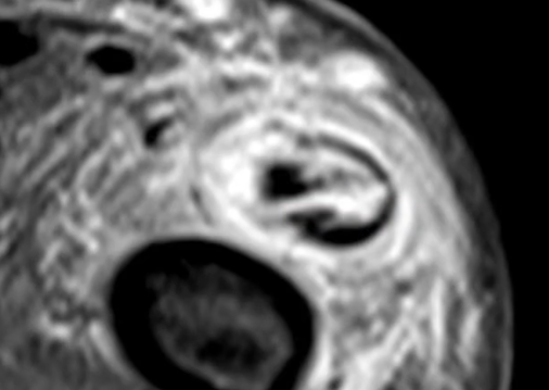 e03dac7c2c0e410fce608632a583c2ab.png