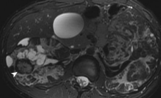 e19634e2fa20ffc986285d690758d770.png